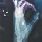 Ungenutzte radiologische Befunde auf Datenträgern: „Was für ein intellektueller Verlust“